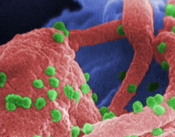 Genetically Engineered Stem Cells A Potential Cure For AIDS image.axd Genetically Engineered Stem Cells A Potential Cure For AIDS